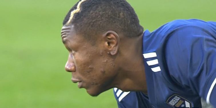 Cdf Samuel Kalu Devrait Etre Trop Juste Pour Le Match De Coupe Face A Toulouse Girondins4ever